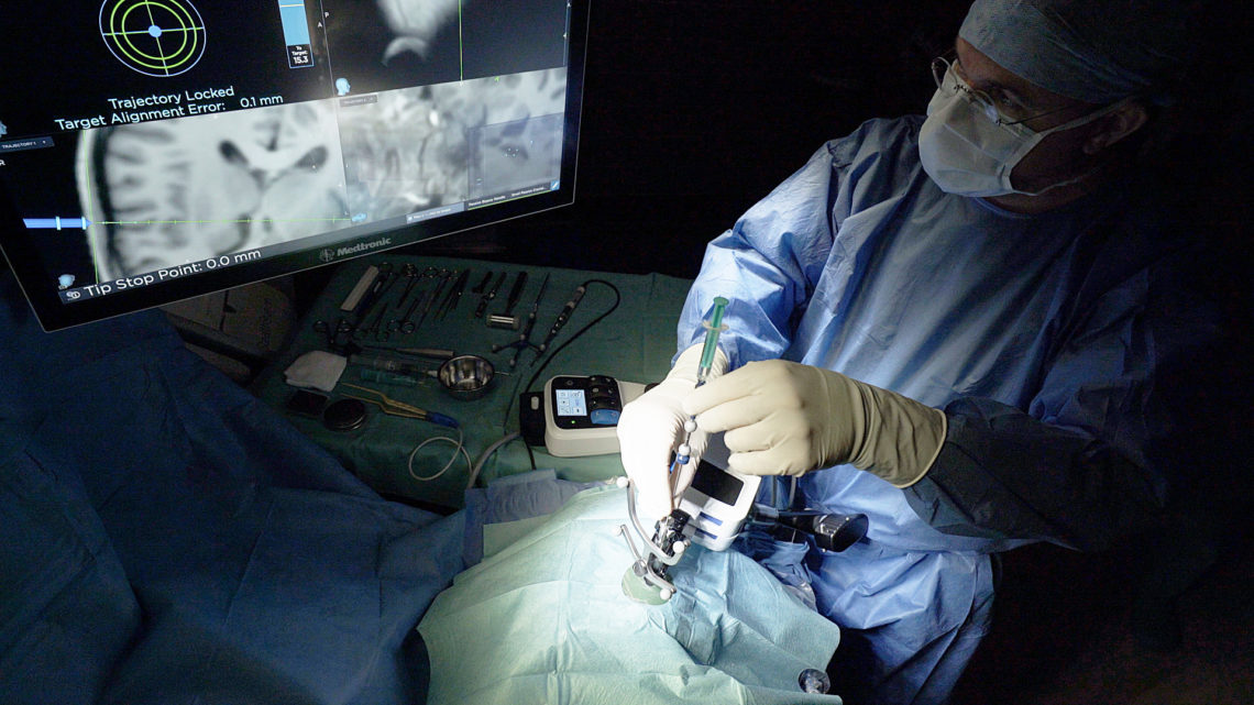 Gehirntumor Operation Roboter Biopsie